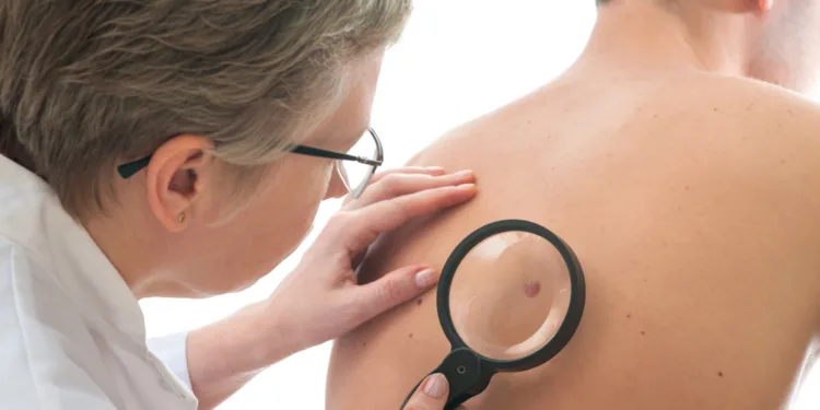 Fewer lung and colon cancer cases, skin and prostate cancers up