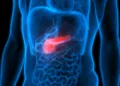 New genetic treatment for pancreatic cancer tested in Nijmegen